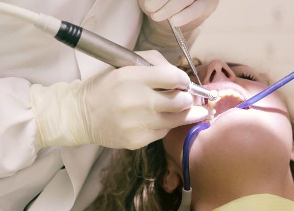 стоимость зубных имплантов в турции